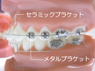 ]̋u